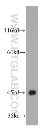 UQCRC1 Antibody in Western Blot (WB)