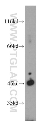 UQCRC1 Antibody in Western Blot (WB)