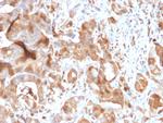 FABP5 Antibody in Immunohistochemistry (Paraffin) (IHC (P))