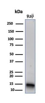 FABP5 Antibody in Western Blot (WB)