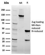 FABP5 (Marker of Metastatic Potential in Colorectal Cancer) Antibody in SDS-PAGE (SDS-PAGE)