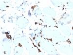 FABP5 (Marker of Metastatic Potential in Colorectal Cancer) Antibody in Immunohistochemistry (Paraffin) (IHC (P))