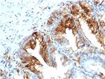 FABP5 (Marker of Metastatic Potential in Colorectal Cancer) Antibody in Immunohistochemistry (Paraffin) (IHC (P))