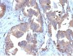 FABP5 (Marker of Metastatic Potential in Colorectal Cancer) Antibody in Immunohistochemistry (Paraffin) (IHC (P))