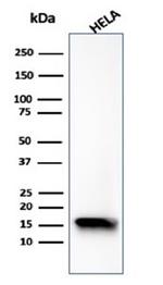 FABP5 (Marker of Metastatic Potential in Colorectal Cancer) Antibody in Western Blot (WB)