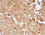 FABP5 (Marker of Metastatic Potential in Colorectal Cancer) Antibody in Immunohistochemistry (Paraffin) (IHC (P))