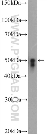 ZIC3 Antibody in Western Blot (WB)