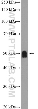 ZIC3 Antibody in Western Blot (WB)