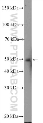 ZIC3 Antibody in Western Blot (WB)