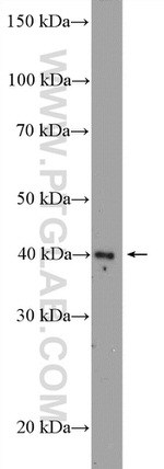 ZIC3 Antibody in Western Blot (WB)