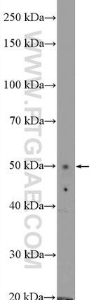 ZIC3 Antibody in Western Blot (WB)