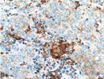 PFKFB1 Antibody in Immunohistochemistry (Paraffin) (IHC (P))