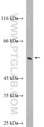 PFKFB1 Antibody in Western Blot (WB)