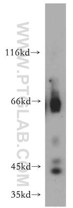 INPP5A Antibody in Western Blot (WB)