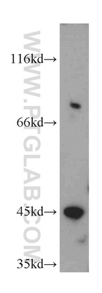 INPP5A Antibody in Western Blot (WB)