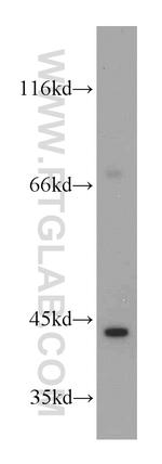 INPP5A Antibody in Western Blot (WB)