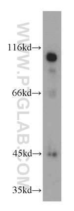 KANK2 Antibody in Western Blot (WB)