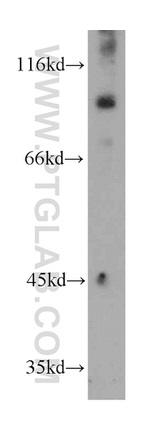 KANK2 Antibody in Western Blot (WB)