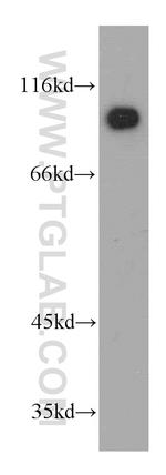 KANK2 Antibody in Western Blot (WB)