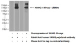 KANK2 Antibody in Western Blot (WB)