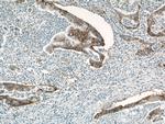 Integrin beta-4 Antibody in Immunohistochemistry (Paraffin) (IHC (P))