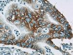 Integrin beta-4 Antibody in Immunohistochemistry (Paraffin) (IHC (P))