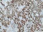 Integrin beta-4 Antibody in Immunohistochemistry (Paraffin) (IHC (P))