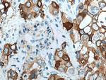 Integrin beta-4 Antibody in Immunohistochemistry (Paraffin) (IHC (P))