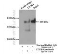 Integrin beta-4 Antibody in Immunoprecipitation (IP)