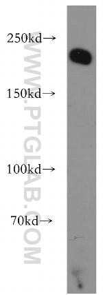 Integrin beta-4 Antibody in Western Blot (WB)