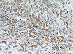 Integrin beta-4 Antibody in Immunohistochemistry (Paraffin) (IHC (P))