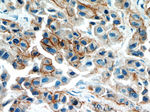 Integrin beta-4 Antibody in Immunohistochemistry (Paraffin) (IHC (P))