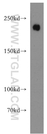 Integrin beta-4 Antibody in Western Blot (WB)