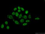 PI3K p110(beta) Antibody in Immunocytochemistry (ICC/IF)