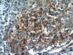 PI3K p110(beta) Antibody in Immunohistochemistry (Paraffin) (IHC (P))