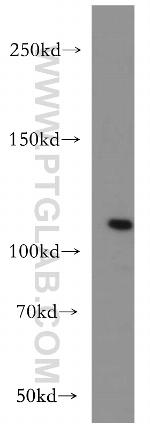 PI3K p110(beta) Antibody in Western Blot (WB)