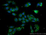 CARD11 Antibody in Immunocytochemistry (ICC/IF)