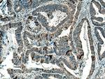 CARD11 Antibody in Immunohistochemistry (Paraffin) (IHC (P))