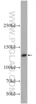 CARD11 Antibody in Western Blot (WB)