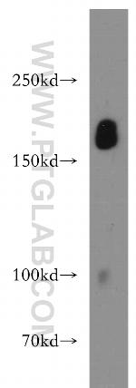 pregnancy zone protein Antibody in Western Blot (WB)