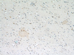 pregnancy zone protein Antibody in Immunohistochemistry (Paraffin) (IHC (P))