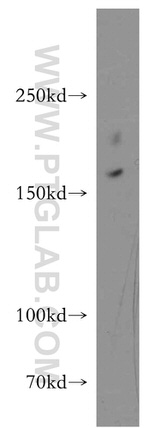 pregnancy zone protein Antibody in Western Blot (WB)