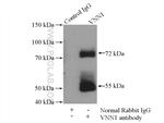 VNN1 Antibody in Immunoprecipitation (IP)