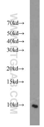 HIGD1A Antibody in Western Blot (WB)