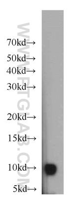 HIGD1A Antibody in Western Blot (WB)