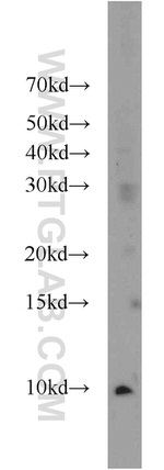 HIGD1A Antibody in Western Blot (WB)