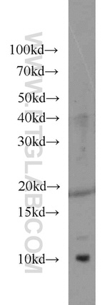 HIGD1A Antibody in Western Blot (WB)