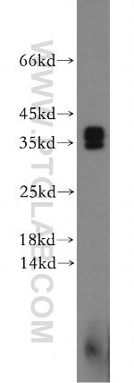 Synaptogyrin-4 Antibody in Western Blot (WB)