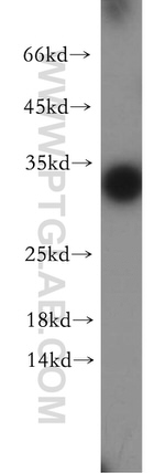 Synaptogyrin-4 Antibody in Western Blot (WB)