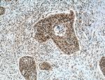 ZNF750 Antibody in Immunohistochemistry (Paraffin) (IHC (P))